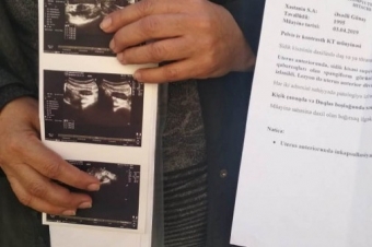 Azərbaycanda həkimdən ŞOK HƏRƏKƏT: Əməliyyat etdiyi xəstəni... - VİDEO