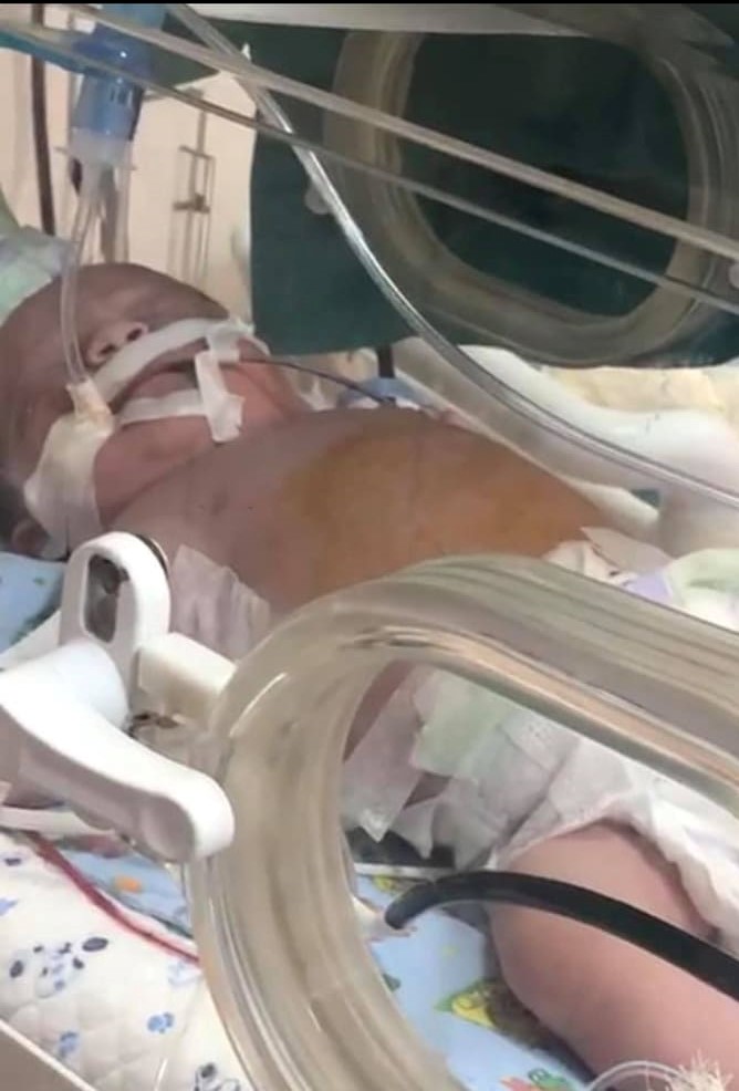 Anası ilə qan uyğunsuzluğu olan uşaq sağ qalıb