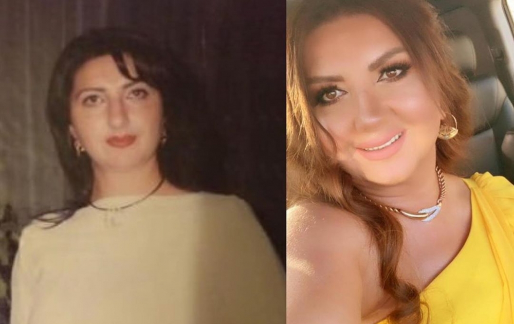 Nazilənin 10 illik dəyişimi - <span style="color:red;">FOTO 