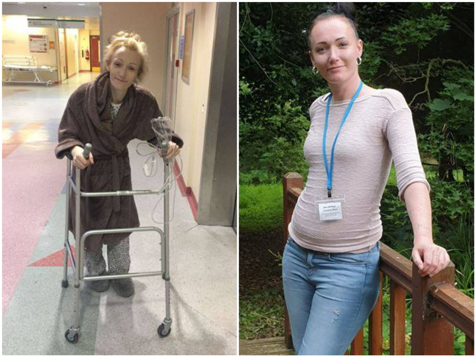 Narkoman qızı görənlər tanımadı: heç kim inanmadı