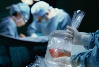 Orqan transplantasiyasına büdcədən PUL AYRILMAYACAQ