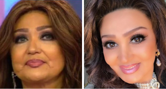 Nazpəri şəkillərinə fotoşop etdi - <span style="color:red;">TƏNQİD OLUNDU  