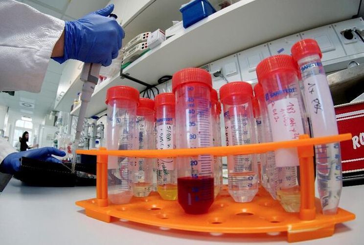 Hamı koronavirus testindən keçməlidir? - AÇIQLAMA