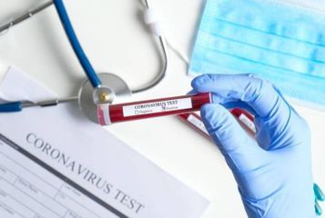 Ermənistanda koronavirusa yoluxanların sayı 770 nəfərə çatdı