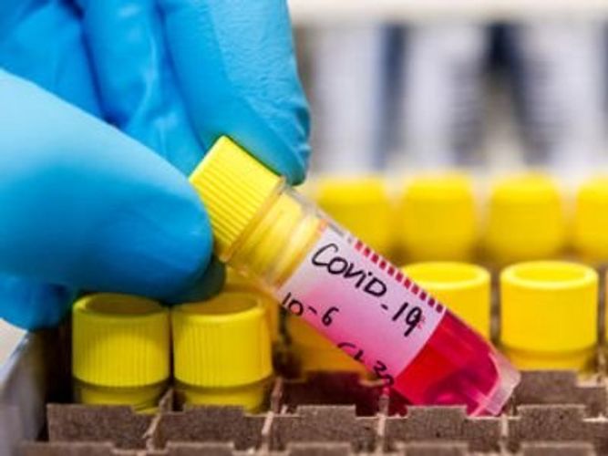 Ermənistanda daha 20 nəfər koronavirusa yoluxdu