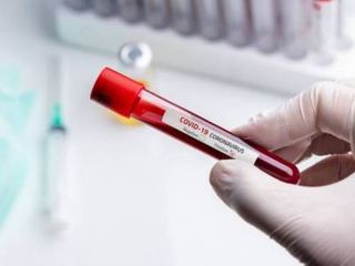 Koronavirusun qan ilə yoluxduğu təsdiqlənməyib - TƏBİB