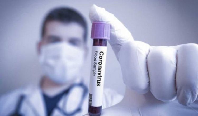 Bu ölkədə yaşayan Azərbaycan vətəndaşlarında koronavirus aşkarlandı