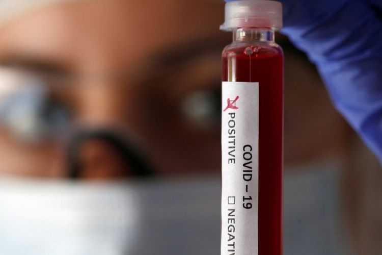 İranda  koronavirusdan ölənlərin sayı açıqlandı