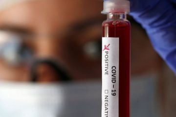 İranda  koronavirusdan ölənlərin sayı açıqlandı