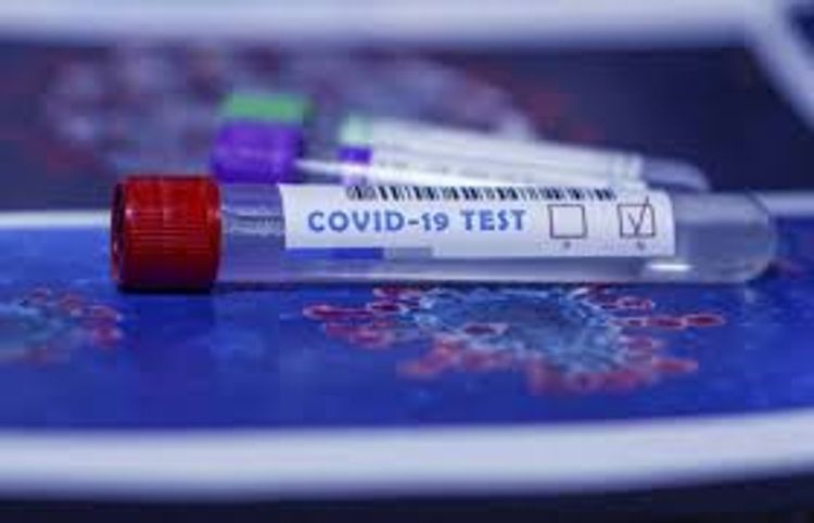 Xaricdən gəlib test verməyənlərə qarşı bu tədbir görüləcək - Hikmət Hacıyev
