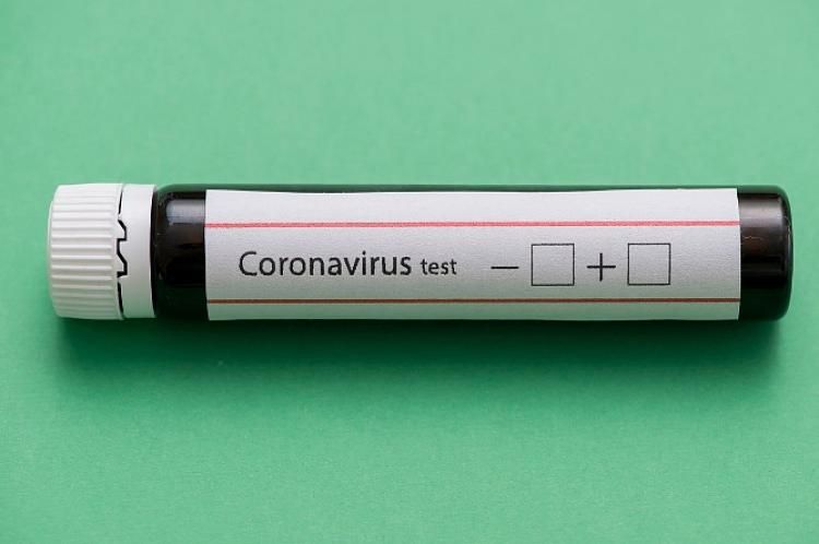 Rusiyada koronavirusdan daha 129 nəfər öldü