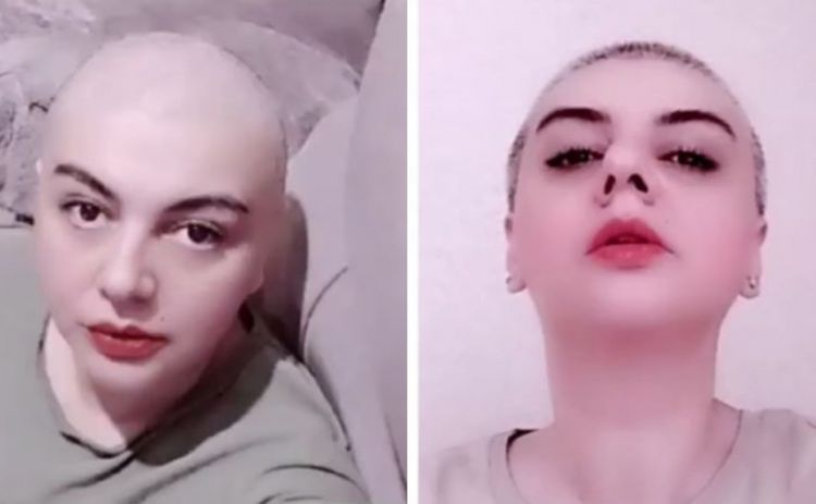 Xanım aparıcı başını keçəl etdi - FOTO