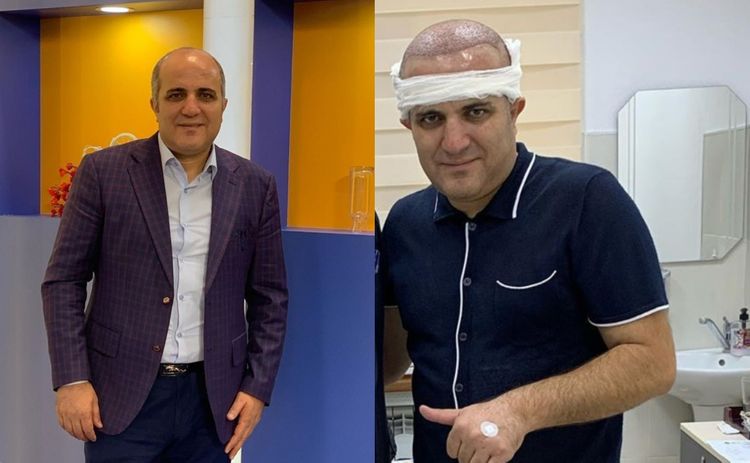 Kişi muğam ifaçısı plastik əməliyyat etdirdi