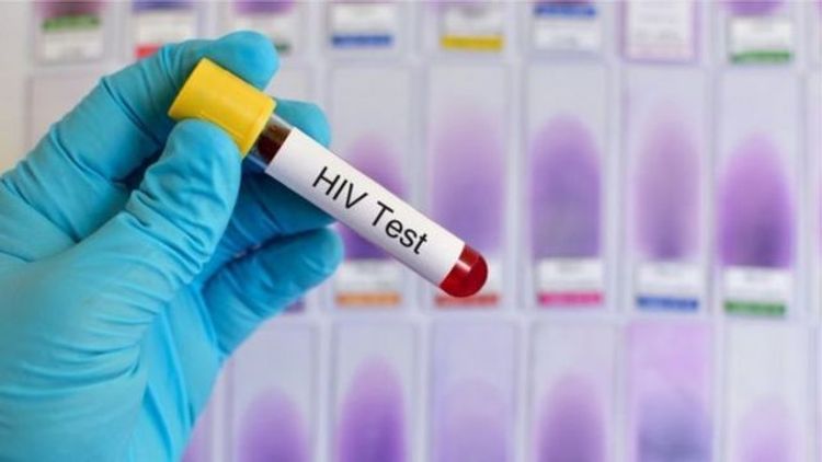 Azərbaycanda QİÇS-ə yoluxma STATİSTİKASI