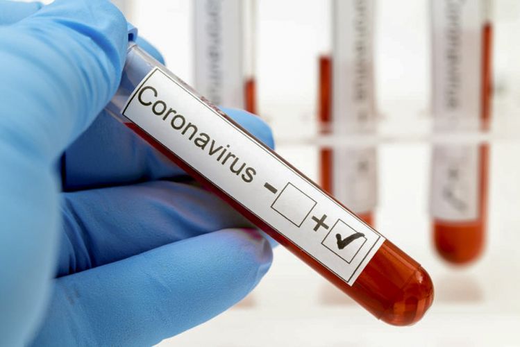 Dünyada COVID-19-dan ölənlərin sayı 1.5 milyonu keçdi