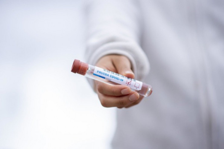 Koronavirus statistikası:   4387 nəfər yoluxdu,  3133 nəfər sağaldı,  38 nəfər vəfat etdi