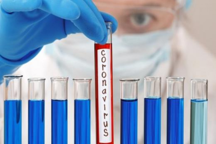 Koronavirusla bağlı son vəziyyət - STATİSTİKA 