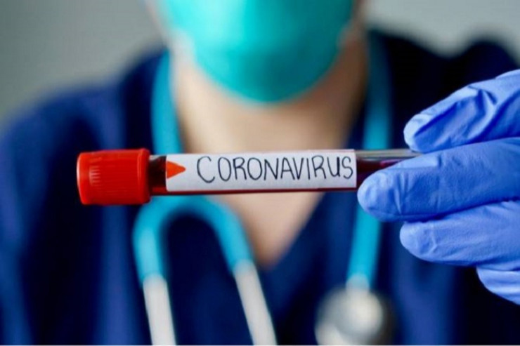 Koronavirusla bağlı son  STATİSTİKA 