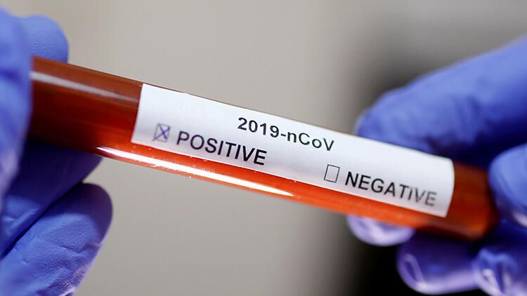 Türkiyə və İran səhiyyə nazirləri koronavirus təhlükəsindən danışıblar