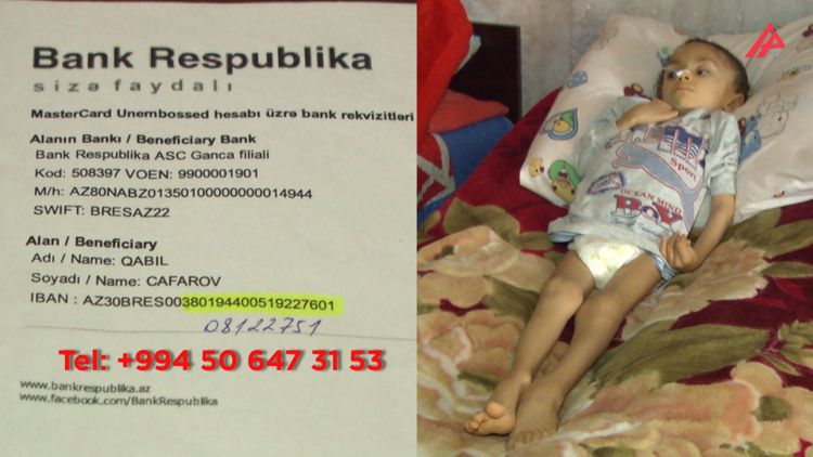 7 yaşlı Yusifin köməyə ehtiyacı var - SOS