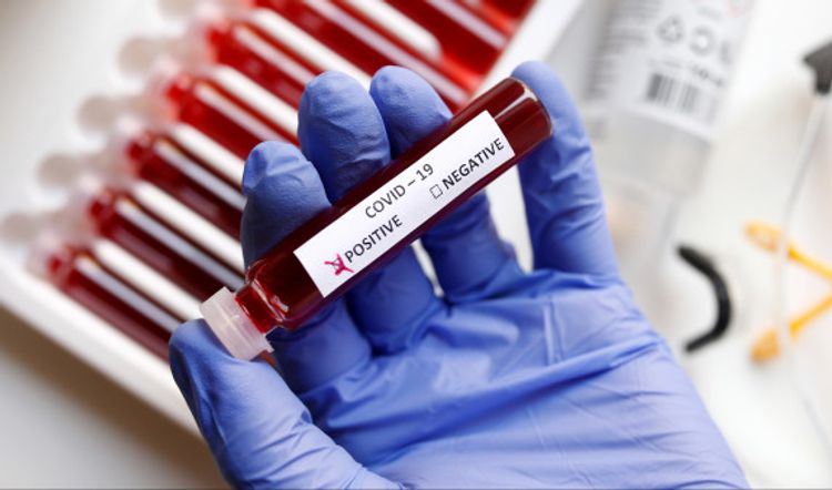 Bu televizyanın 4 əməkdaşında koronavirus aşkarlandı