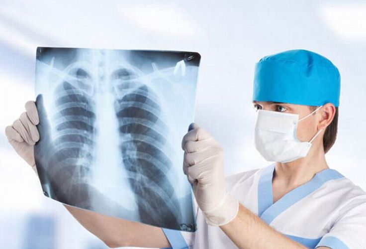 Azərbaycanda son zamanlar pnevmaniya niyə çox yayılıb? - Baş infeksionistdən CAVAB