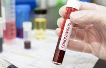 Təyyarə sərnişinləri üçün test laboratoriyalarının sayı artırıldı