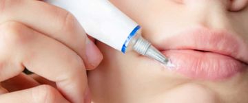 Ömür boyu orqanizmdə yaşayan virus: Herpes müalicə olunurmu?