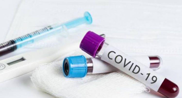 Azərbaycanda daha 478 nəfərdə koronavirus aşkarlandı, 369 nəfər sağaldı, 7 nəfər öldü