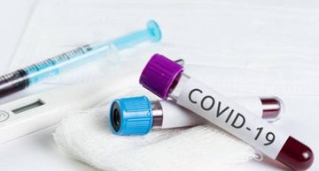 Azərbaycanda daha 478 nəfərdə koronavirus aşkarlandı, 369 nəfər sağaldı, 7 nəfər öldü