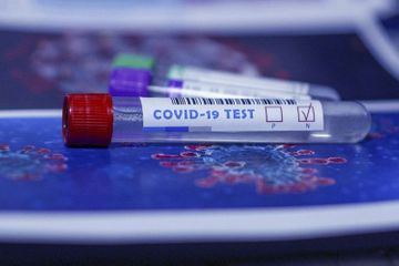 Azərbaycanda daha 590 nəfərdə koronavirus aşkarlandı, 265 nəfər sağaldı, 7 nəfər öldü