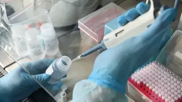 Çexiyada ilk dəfə 3 nəfər koronavirusa yoluxub
