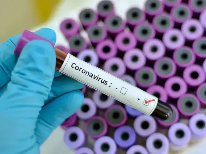 Gürcüstanda koronavirusa yoluxanların sayı 4-ə çatdı