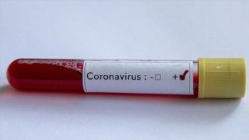 Koronavirus əlamətləri olanlar arasında həkimlərə zor tətbiq edənlər var: QƏRARGAH 