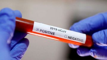 İtaliyada koronavirus qurbanlarının sayı 197-yə yüksəlib