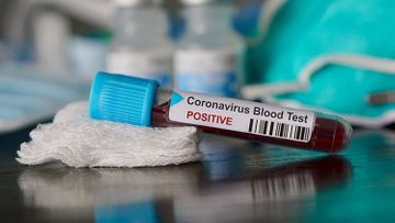 TƏBİB: Koronavirus testinin şəxsi istəyə bağlı olunmaması tövsiyə edilir