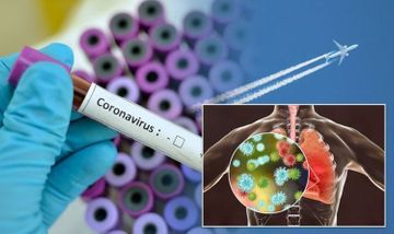 Dünyada koronavirusa yoluxan və ölənlərin son statistikası açıqlandı 