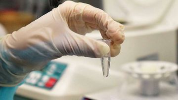 Koronavirus daşıyıcıları ən çox nə vaxt yoluxucudur? - AÇIQLAMA