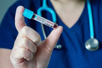 Baş epidemioloq: "Rusiyada koronavirusa yoluxma halı pik həddə yaxınlaşır"