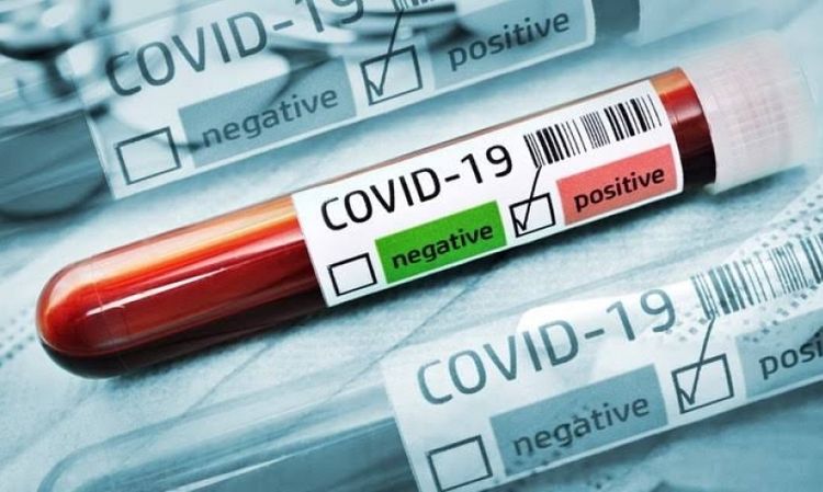 Daha 104 nəfərdə koronavirus aşkarlanıb, 55 nəfər sağalıb, 1 nəfər vəfat edib