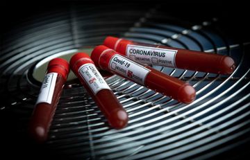 Azərbaycanda daha 248 nəfərdə koronavirus aşkarlandl, 101 nəfər sağaldı, 2 nəfər vəfat etdi