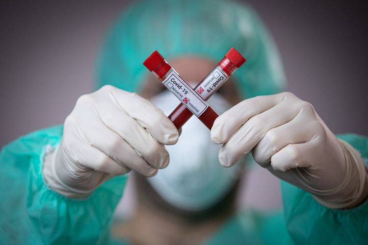 Ermənistanda koronavirusdan ölənlərin sayı 29 nəfər artdı