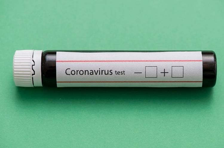 Rusiyada koronavirusdan son sutkada 411 nəfər ölüb