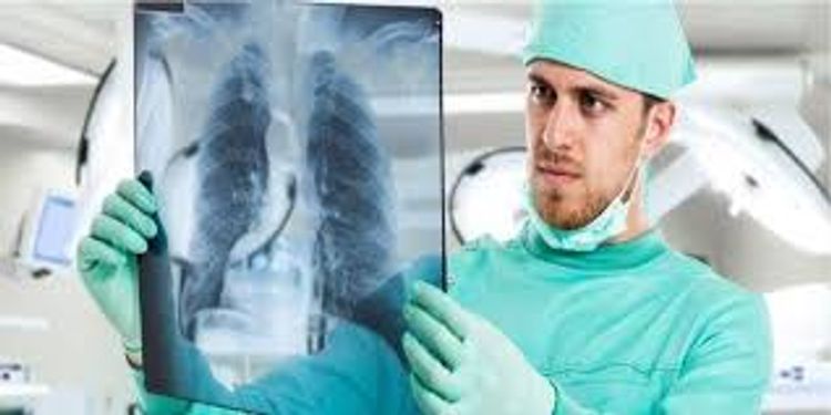 Rusiyalı virusoloq ağciyərlə bağlı koronavirus diaqnozunun yeganə üsulunu açıqladı