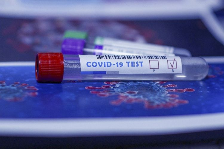 Rusiyada son sutkada 13 868 nəfər COVID-19-a yoluxdu