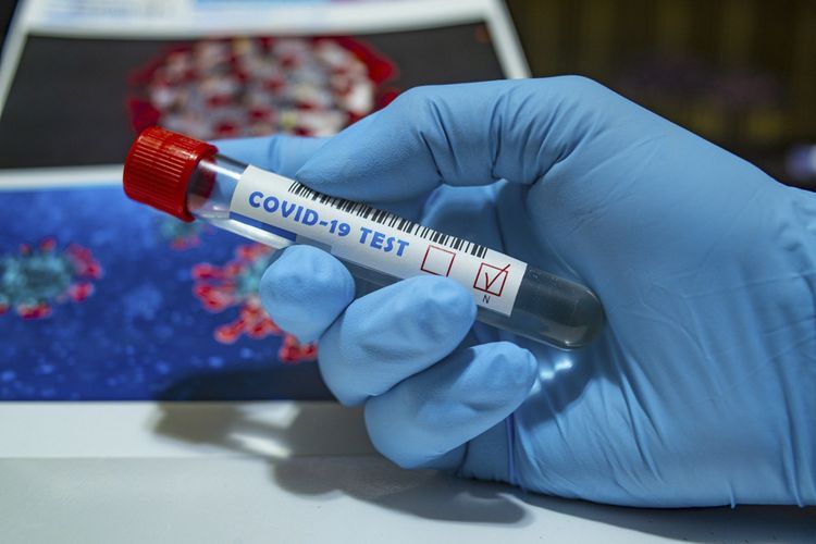 "Test sayları pozitiv xəstələrin təmasları ilə də bağlıdır" - TƏBİB