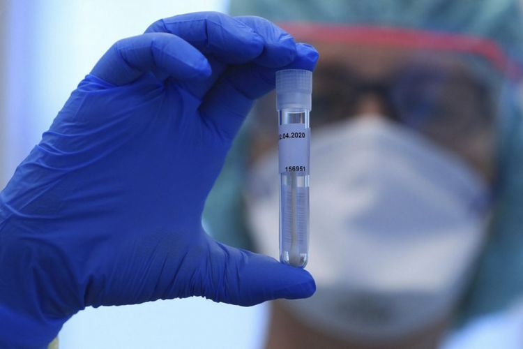 Rusiyada koronavirusdan ölənlərin sayı 25 mini ötdü