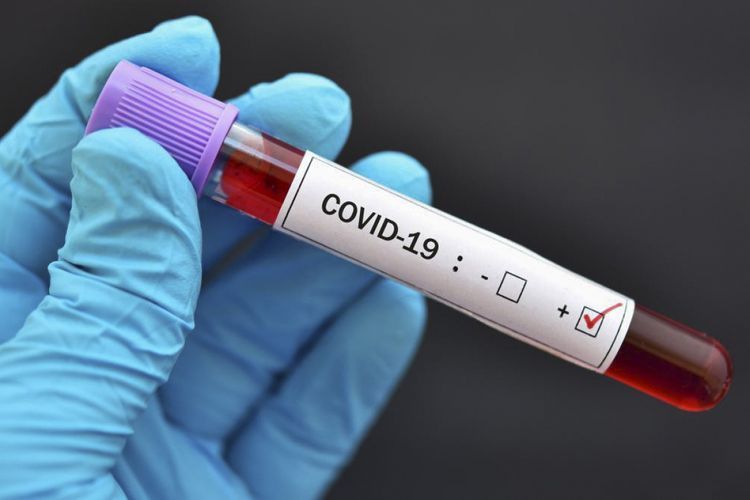 Gürcüstanda koronavirusdan ölənlərin sayı 200-ü keçdi