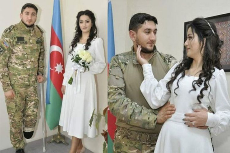 Ayağını itirmiş qazi ilə ailə quran Günelin gözləri