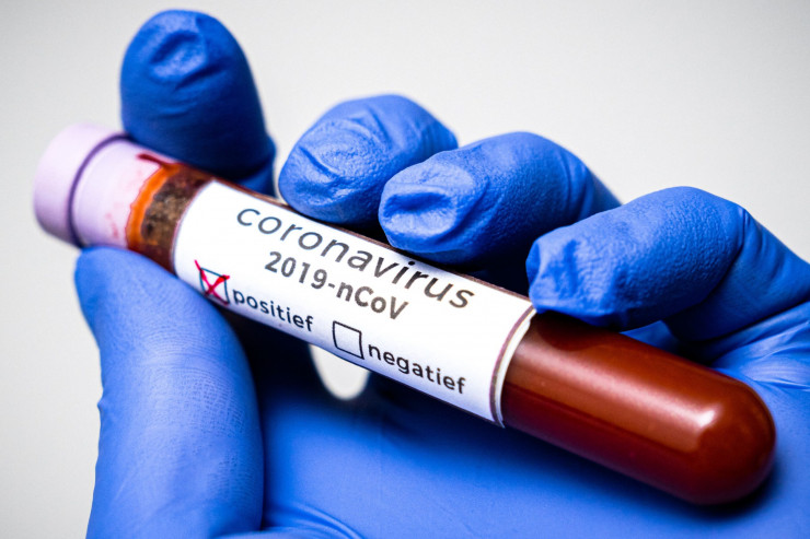 Milyarderlərə koronavirus pandemiyası ilə bağlı CİDDİ İTTİHAM 